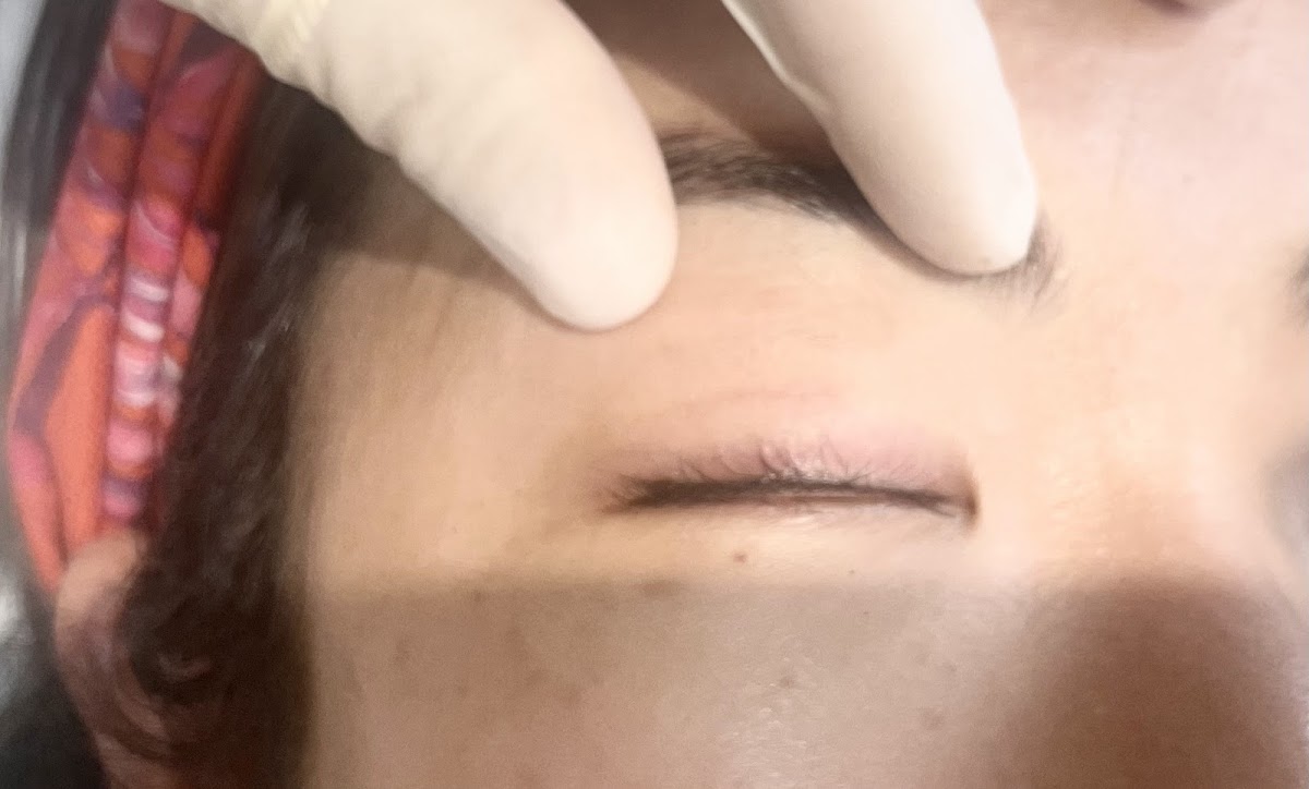 Annebrows permanent brow before and after