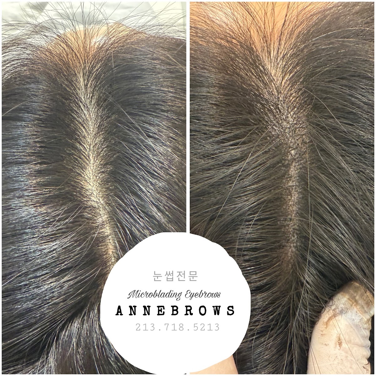 Annebrows permanent brow before and after