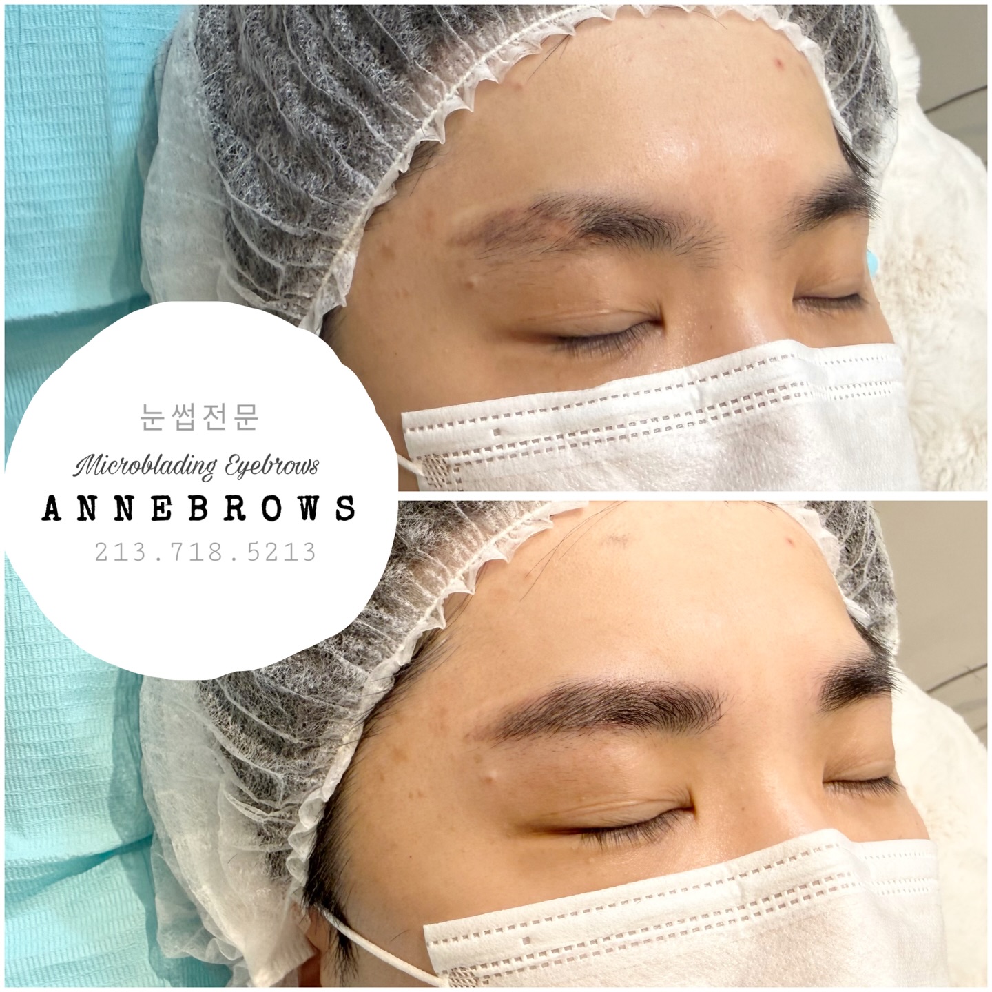 Annebrows permanent brow before and after