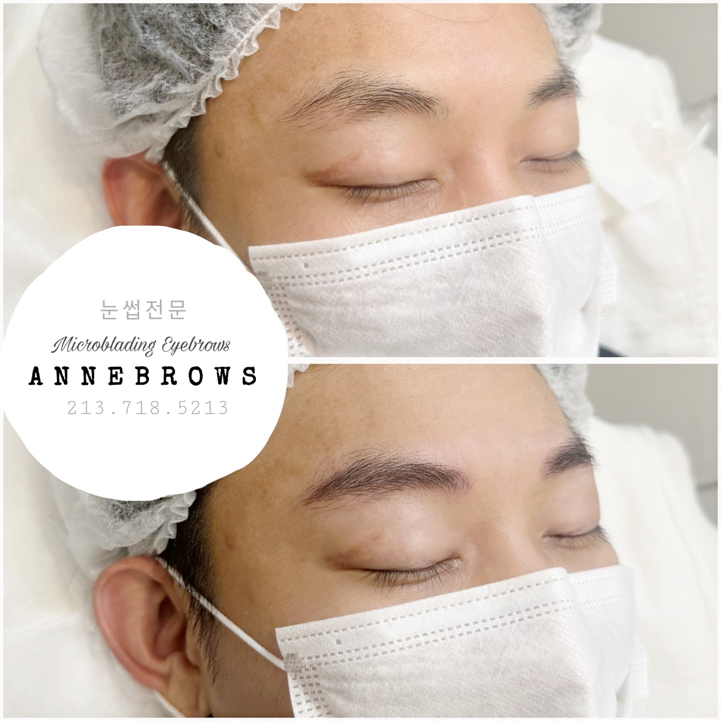 Annebrows permanent brow before and after